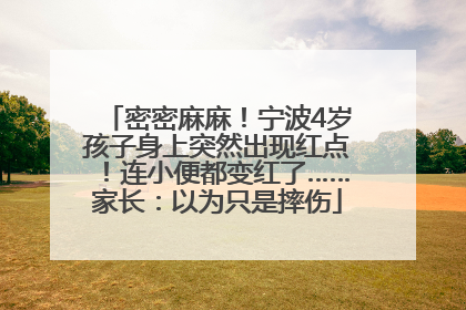 密密麻麻！宁波4岁孩子身上突然出现红点！连小便都变红了……家长：以为只是摔伤
